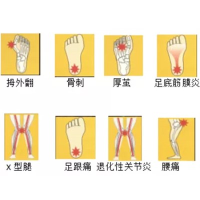 5.29爱足日 大型足脊姿势异常免费评估筛查活动